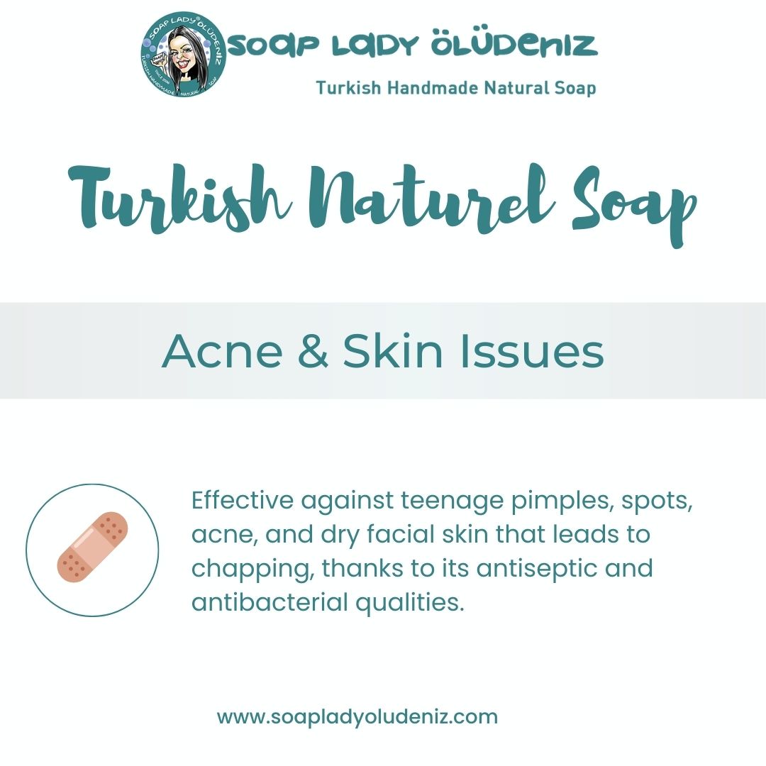 Soap Lady Oludeniz - Carnation Soap