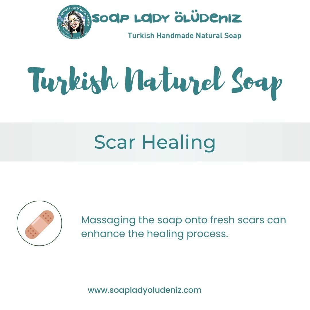 Soap Lady Oludeniz - Rose Hip Soap